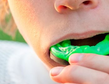 5 Facts about Your Sports Mouth Guard