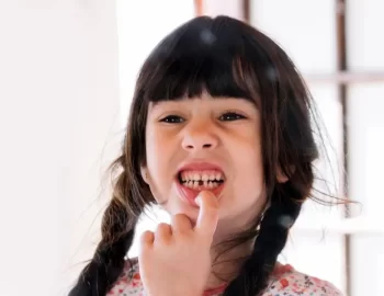 What to Do When Your Child Loses A Tooth