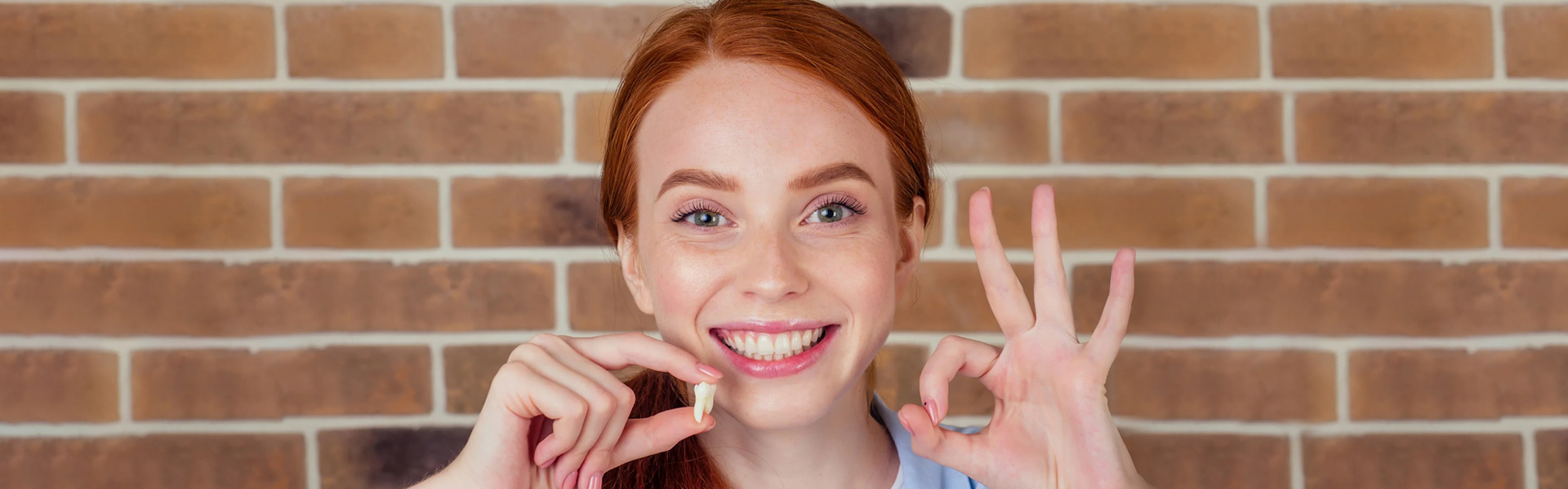 The 4 Best Ways of Treating Broken Teeth