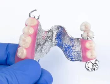 Space Maintainers for Healthy and Beautiful Mouth