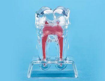 Dental Nerve Pain: Causes, Symptoms, Treatments, and Home Remedies