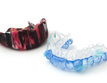 Are Athletic Mouthguards Necessary for Children?