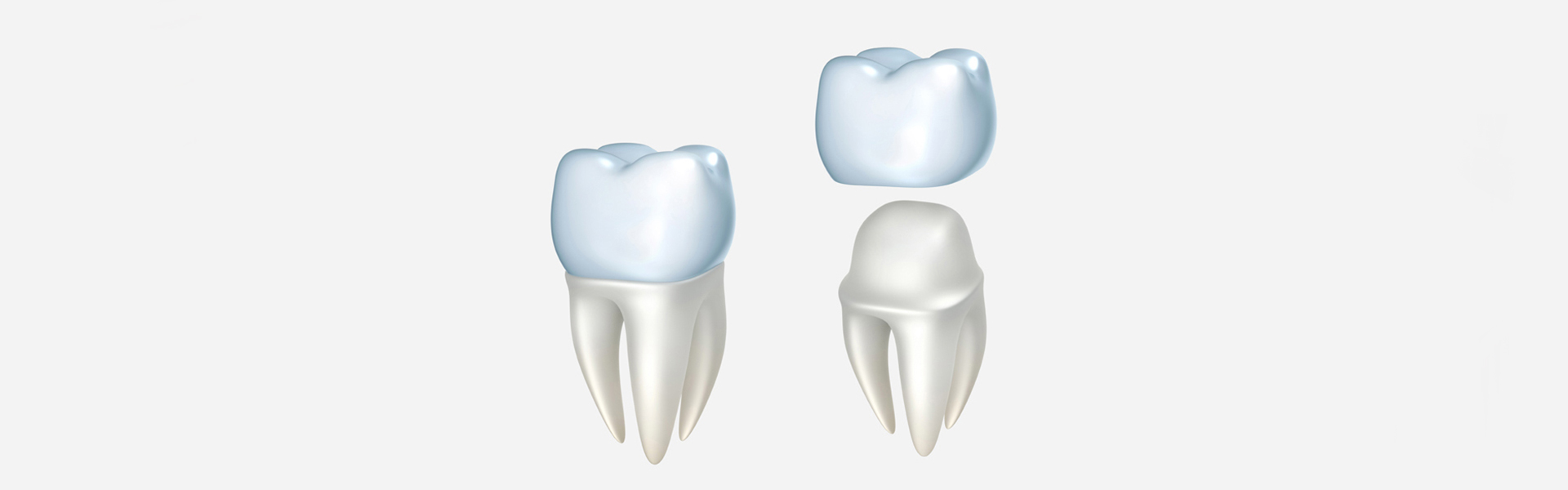 Which Tooth Crown is Best for Kids?