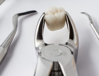 How Does a Tooth Extraction Work? A Simple Step-by-Step Guide